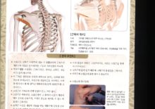 5_06 소원근(작은원근)
