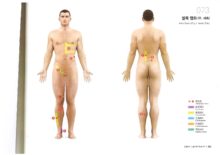관절염(우)_발가락통증(우)