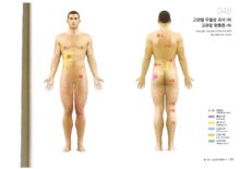 종부원리-다리-고관절 무혈성괴사(좌)_고관절 탈출증(좌)