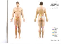 좌골신경통6(우)_무릎통증.(우.내.외측)