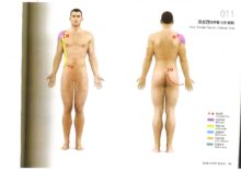 오십견(오른팔.신전 통증)