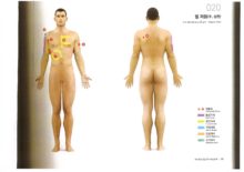 팔 저림(우.상완)